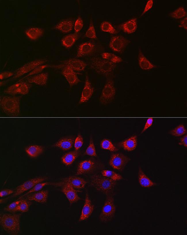 DNM1L Antibody in Immunocytochemistry (ICC/IF)