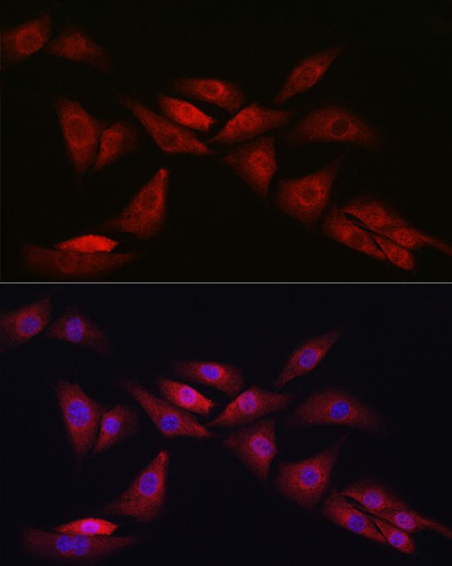 NOTCH1 Antibody in Immunocytochemistry (ICC/IF)