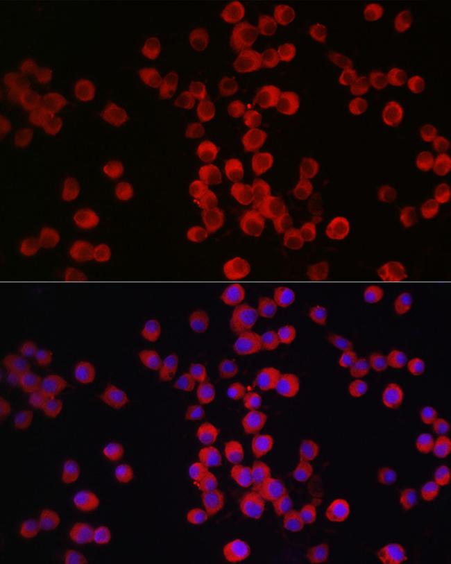 Neuropilin-1 Antibody in Immunocytochemistry (ICC/IF)