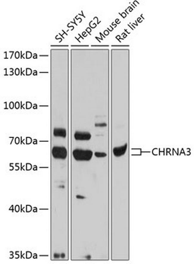 CHRNA3 Antibody in Western Blot (WB)