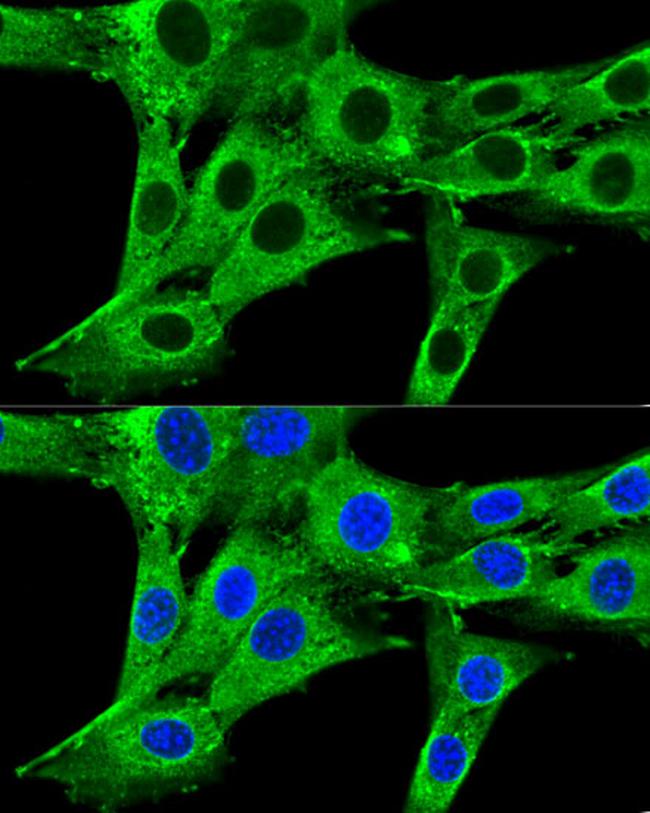 HMGCR Antibody in Immunocytochemistry (ICC/IF)