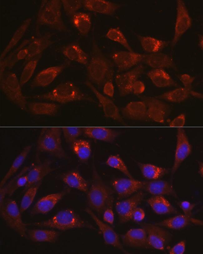 LAMP1 Antibody in Immunocytochemistry (ICC/IF)