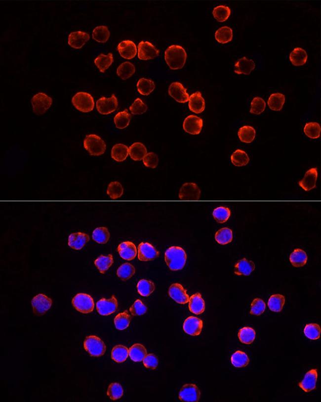 TSG101 Antibody in Immunocytochemistry (ICC/IF)