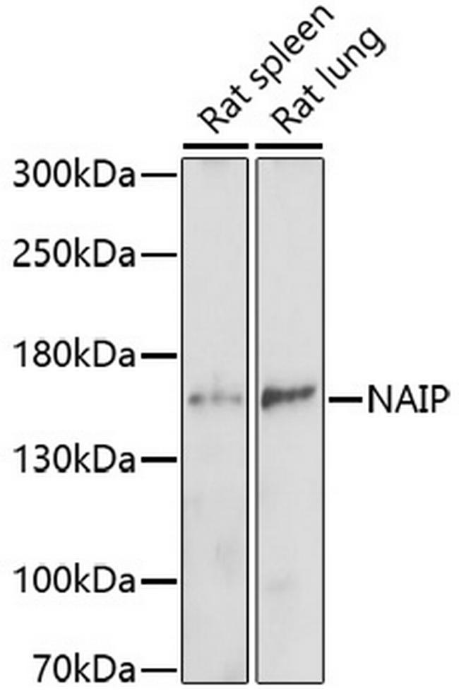 NAIP Antibody in Western Blot (WB)