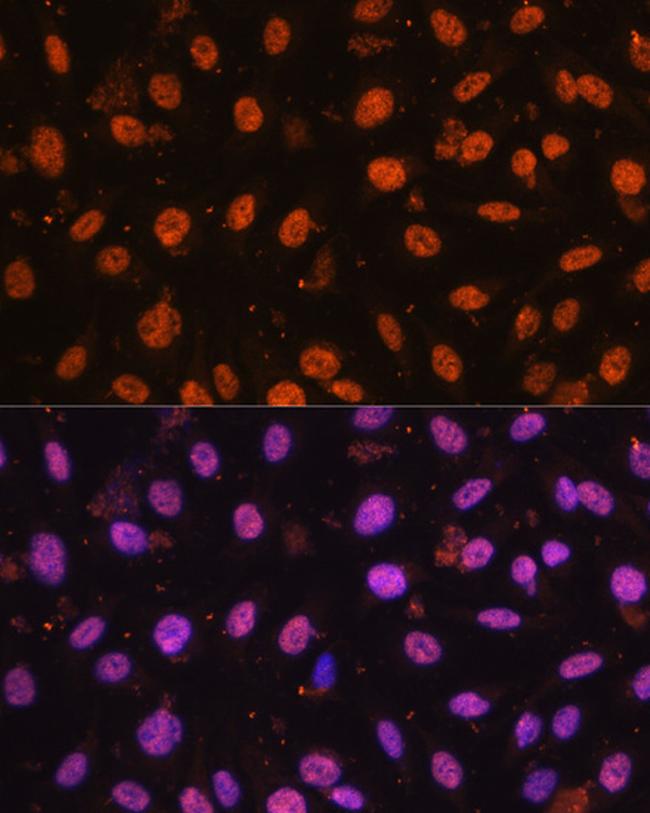 ZEB1 Antibody in Immunocytochemistry (ICC/IF)