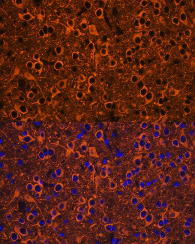 Beta III Tubulin Antibody in Immunohistochemistry (Paraffin) (IHC (P))