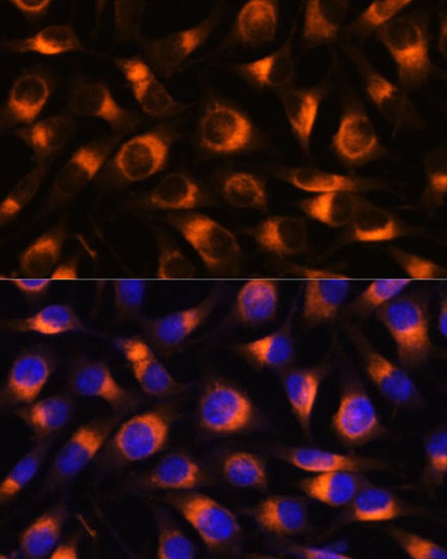 VAT1 Antibody in Immunocytochemistry (ICC/IF)