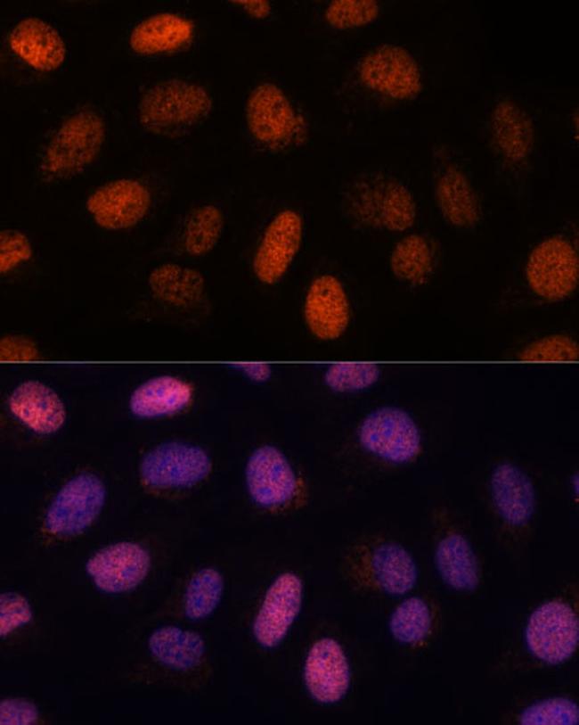 RPP38 Antibody in Immunocytochemistry (ICC/IF)