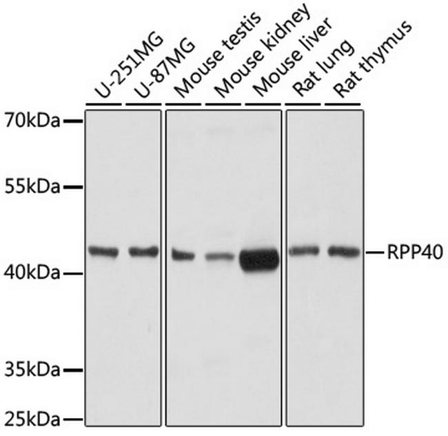 RPP40 Antibody in Western Blot (WB)