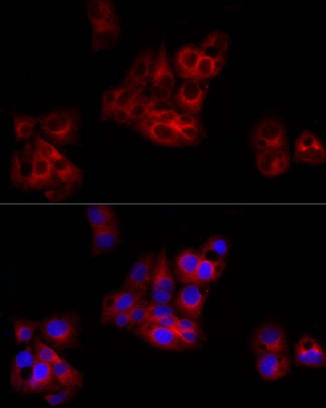 C1 inhibitor Antibody in Immunocytochemistry (ICC/IF)