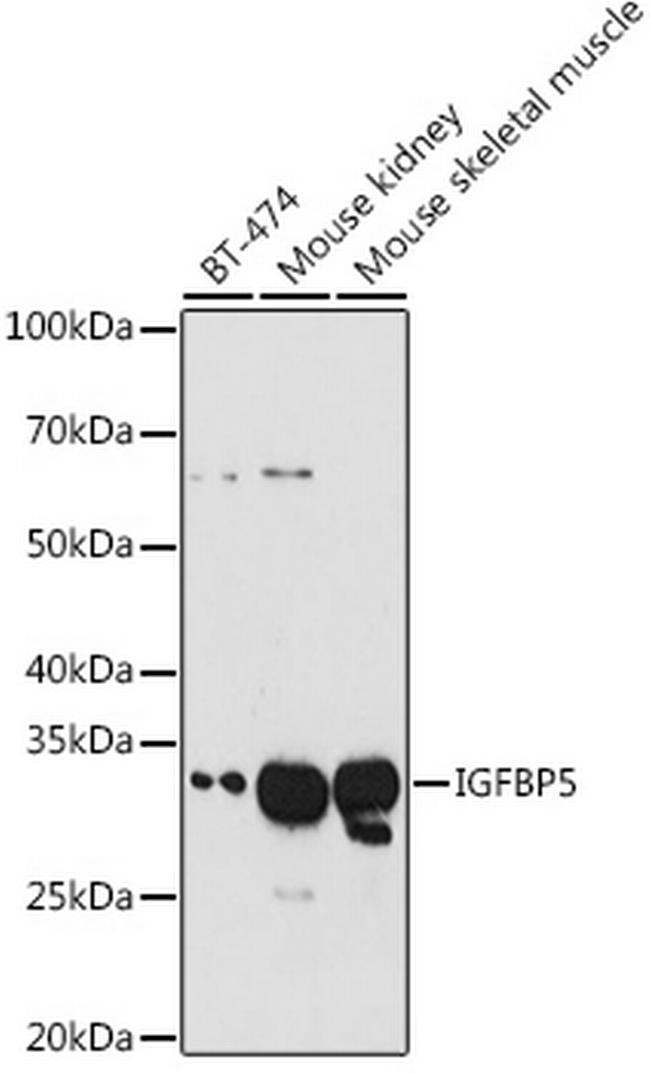 IGFBP5 Antibody in Western Blot (WB)