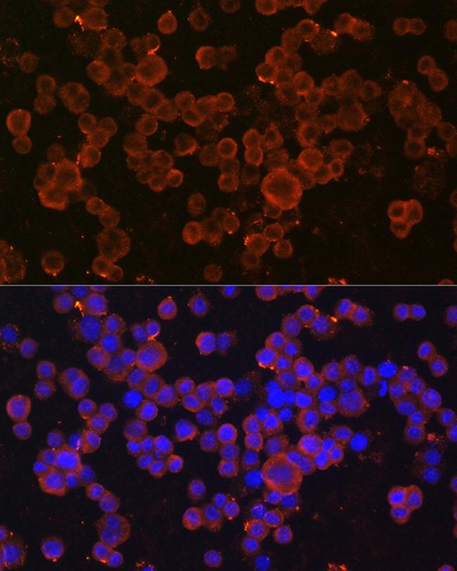 CHI3L1 Antibody in Immunocytochemistry (ICC/IF)