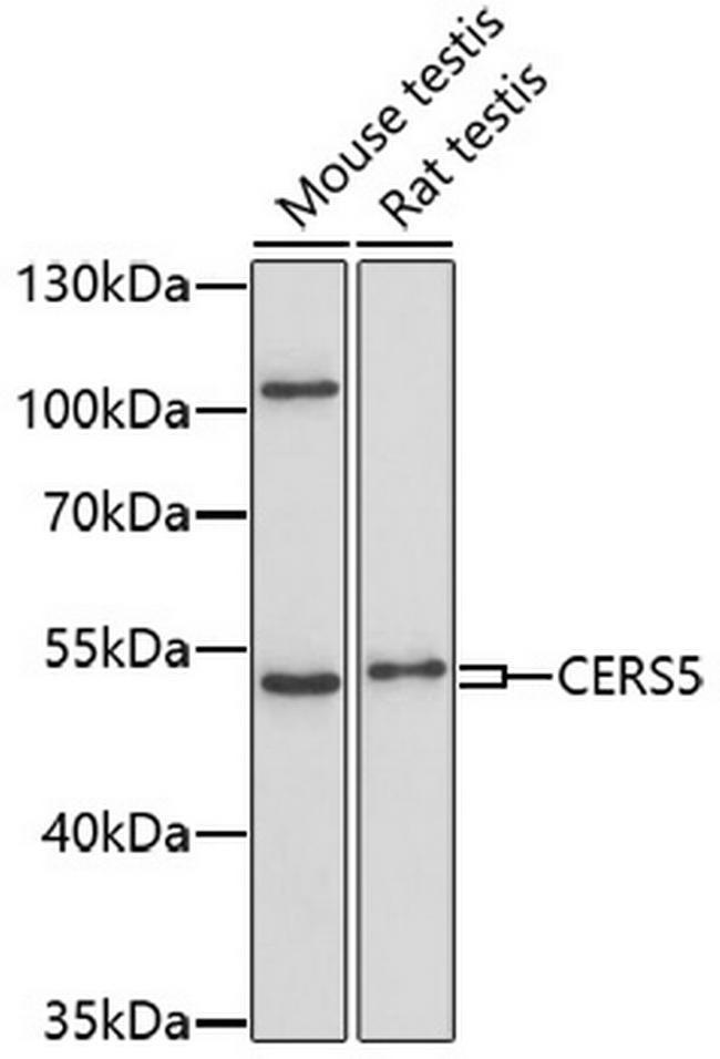 Lass5 Antibody in Western Blot (WB)