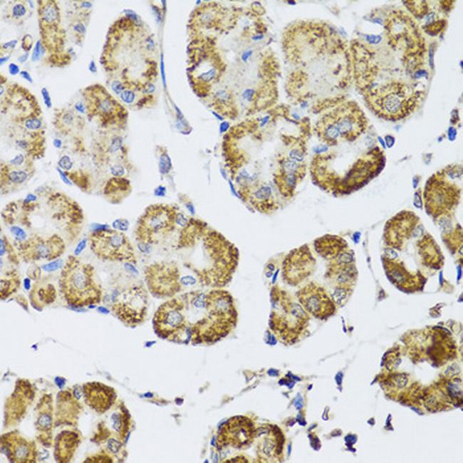 HDAC6 Antibody in Immunohistochemistry (Paraffin) (IHC (P))