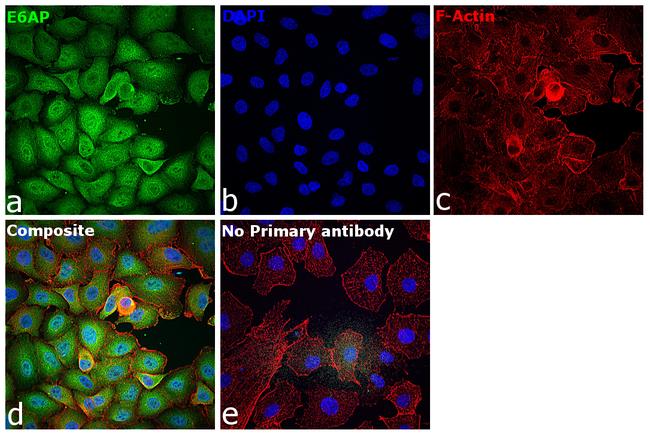 E6AP Antibody in Immunocytochemistry (ICC/IF)