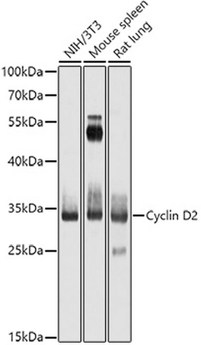 Cyclin D2 Antibody in Western Blot (WB)