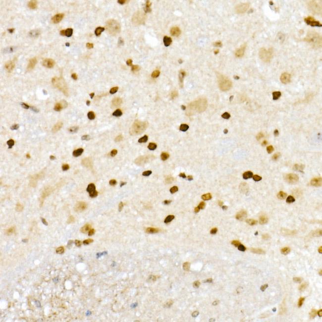 XRCC2 Antibody in Immunohistochemistry (Paraffin) (IHC (P))