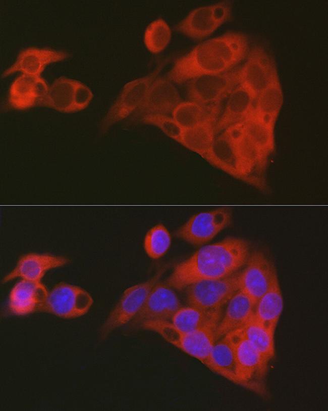 ALDH1A1 Antibody in Immunocytochemistry (ICC/IF)