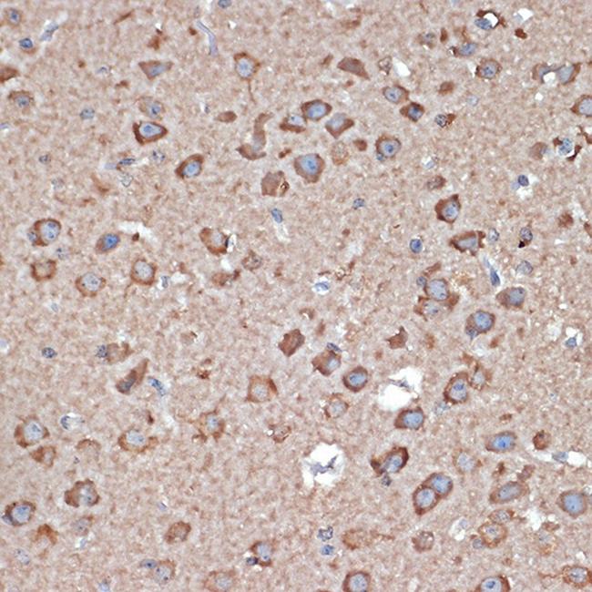 GluR1 Antibody in Immunohistochemistry (Paraffin) (IHC (P))