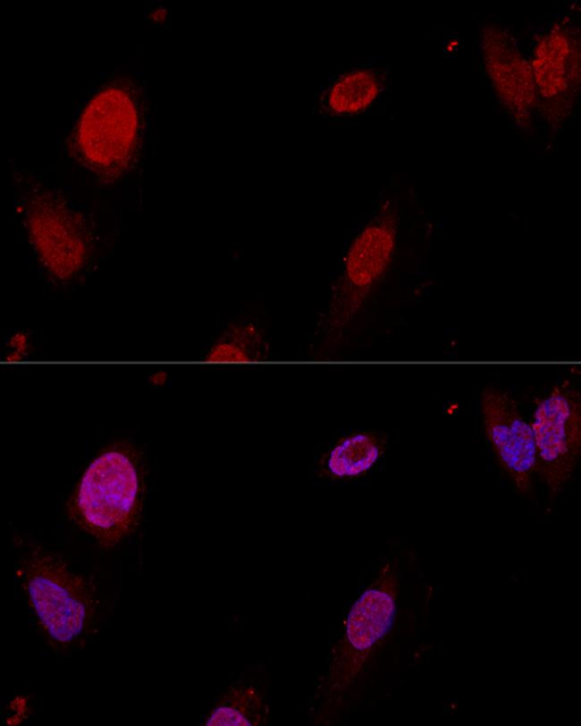 PTBP1 Antibody in Immunocytochemistry (ICC/IF)