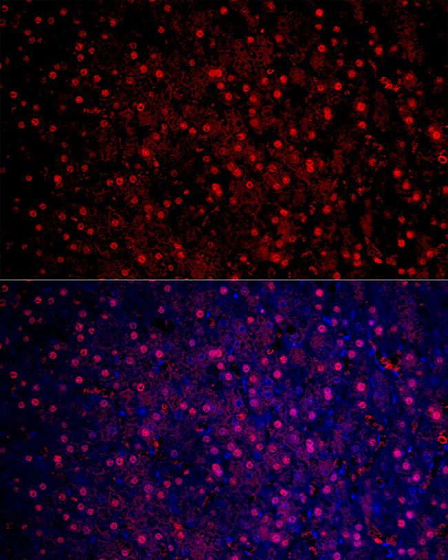 Arginase 1 Antibody in Immunocytochemistry (ICC/IF)