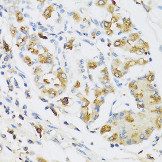 RNASE3 Antibody in Immunohistochemistry (Paraffin) (IHC (P))