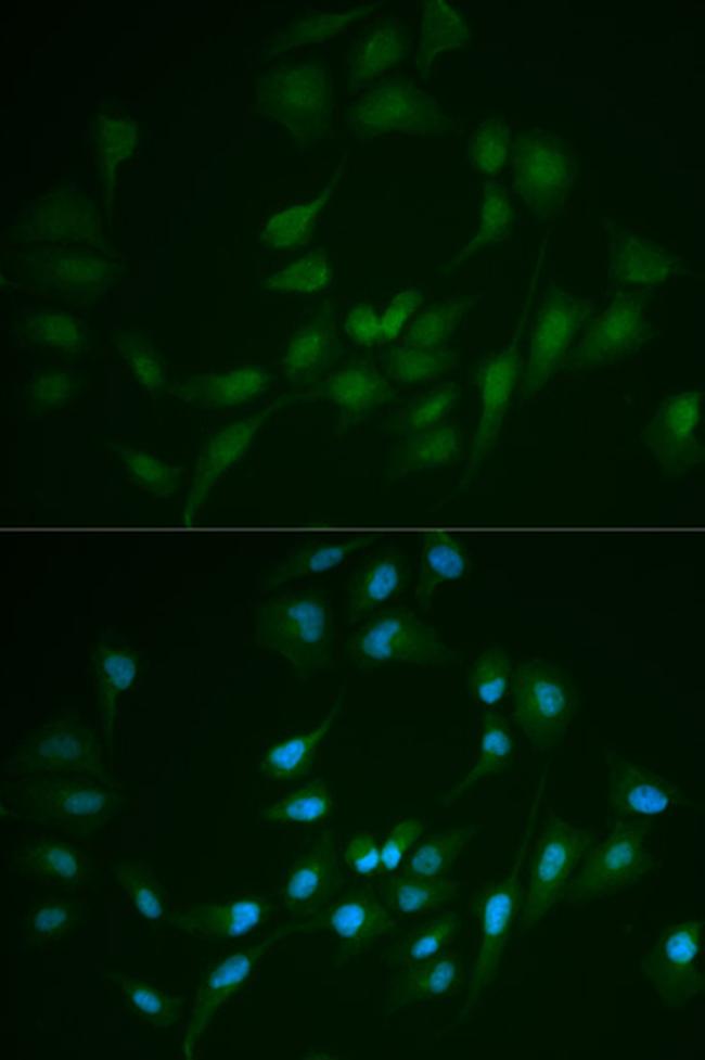 DNA Ligase I Antibody in Immunocytochemistry (ICC/IF)