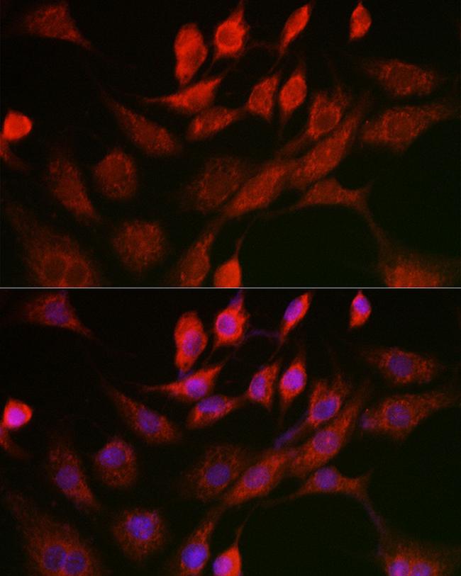 ANT Antibody in Immunocytochemistry (ICC/IF)