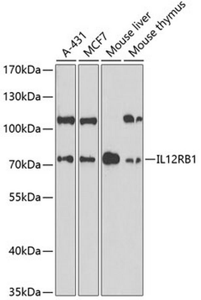 IL12RB1 Antibody in Western Blot (WB)