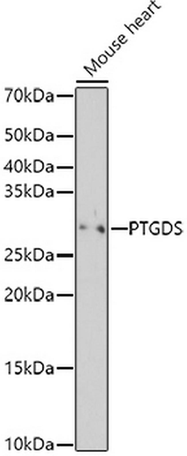 PTGDS Antibody in Western Blot (WB)