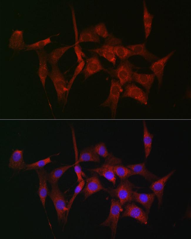 Fascin Antibody in Immunocytochemistry (ICC/IF)