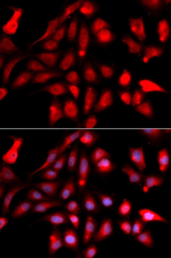 RUVBL2 Antibody in Immunocytochemistry (ICC/IF)