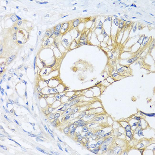 GNAI3 Antibody in Immunohistochemistry (Paraffin) (IHC (P))