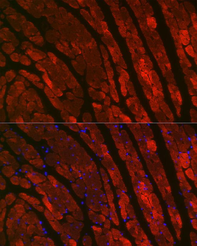 Cardiac Troponin C Antibody in Immunocytochemistry (ICC/IF)