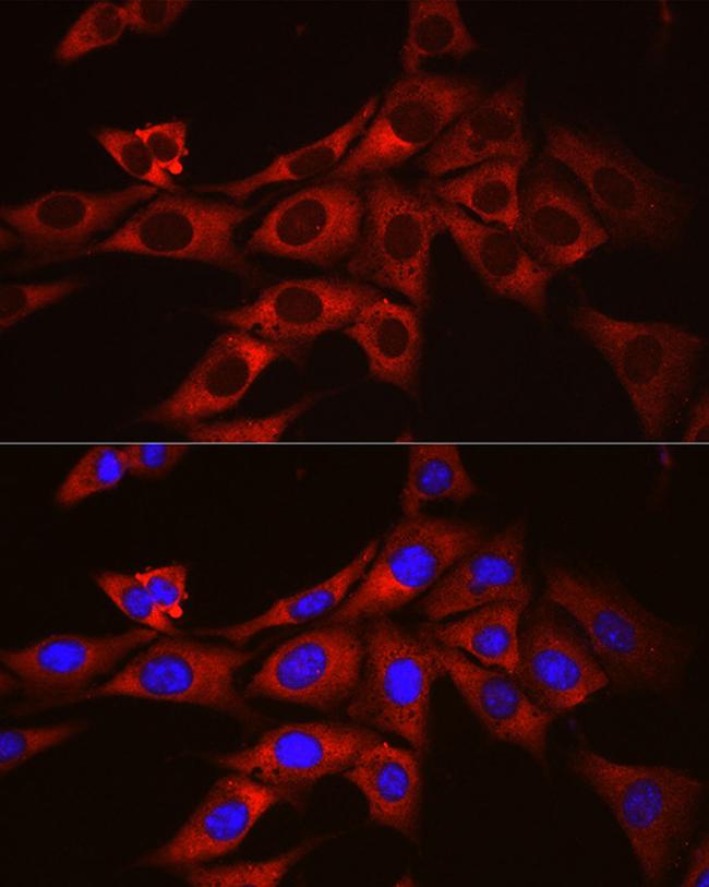 ODC1 Antibody in Immunocytochemistry (ICC/IF)