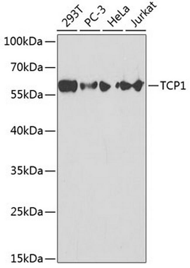 TCP1 Antibody in Western Blot (WB)