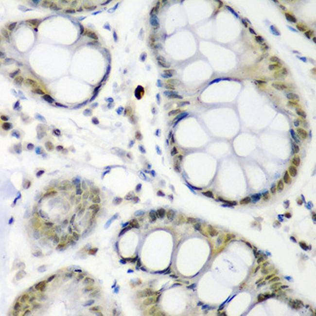 Cdc27 Antibody in Immunohistochemistry (Paraffin) (IHC (P))