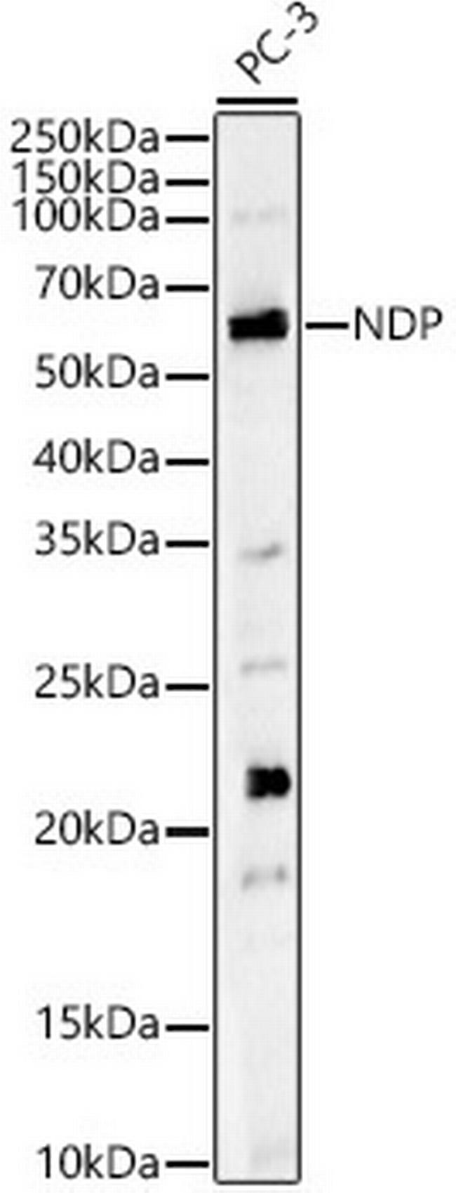 NDP Antibody in Western Blot (WB)