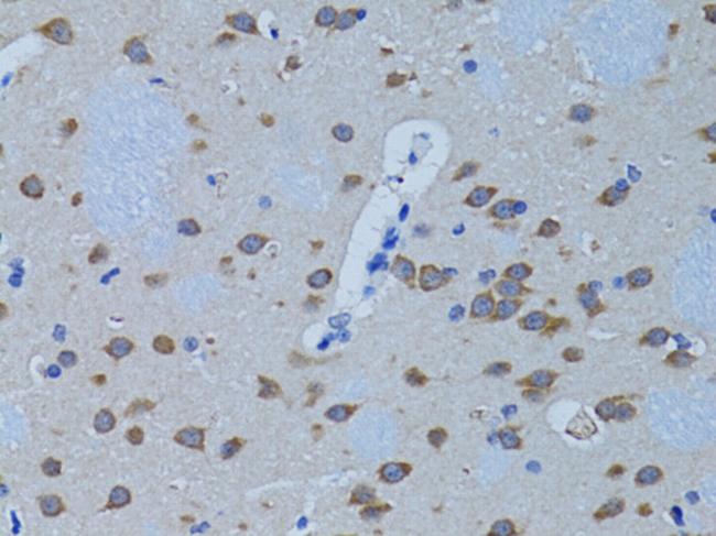 PLCB1 Antibody in Immunohistochemistry (Paraffin) (IHC (P))