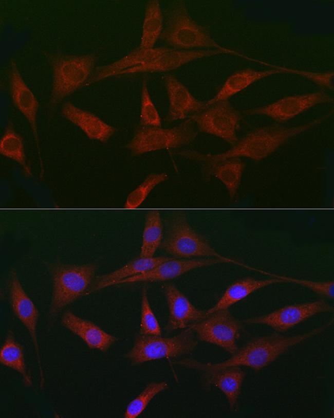 ACVR2A Antibody in Immunocytochemistry (ICC/IF)