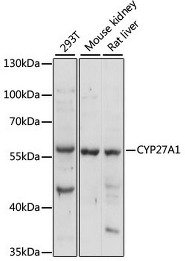 CYP27A1 Antibody in Western Blot (WB)