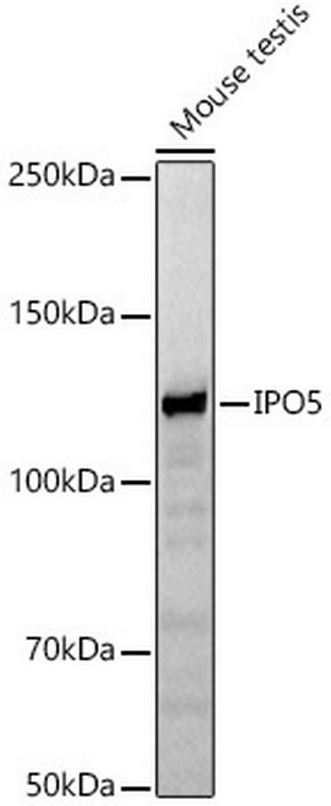 IPO5 Antibody in Western Blot (WB)