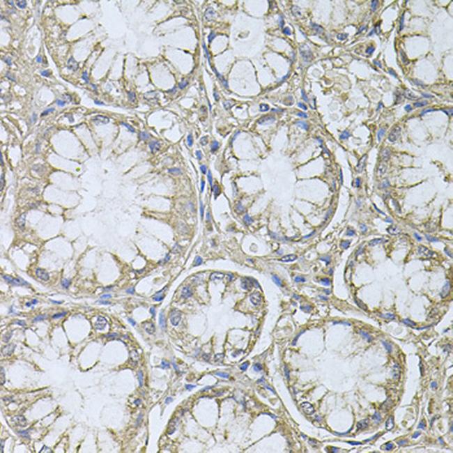 PRL3 Antibody in Immunohistochemistry (Paraffin) (IHC (P))