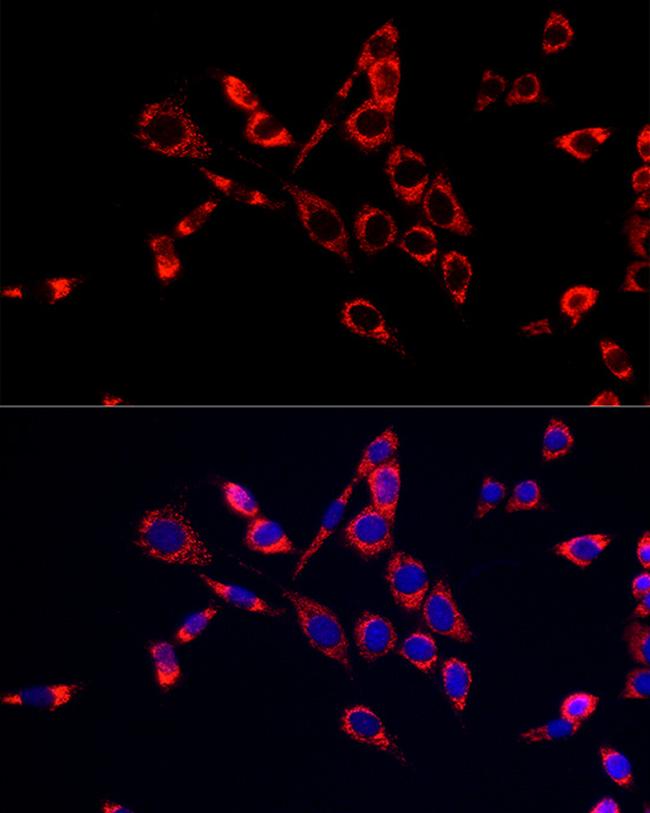 CDA Antibody in Immunocytochemistry (ICC/IF)