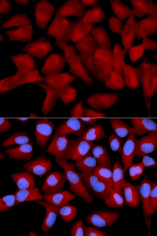 eIF5A Antibody in Immunocytochemistry (ICC/IF)