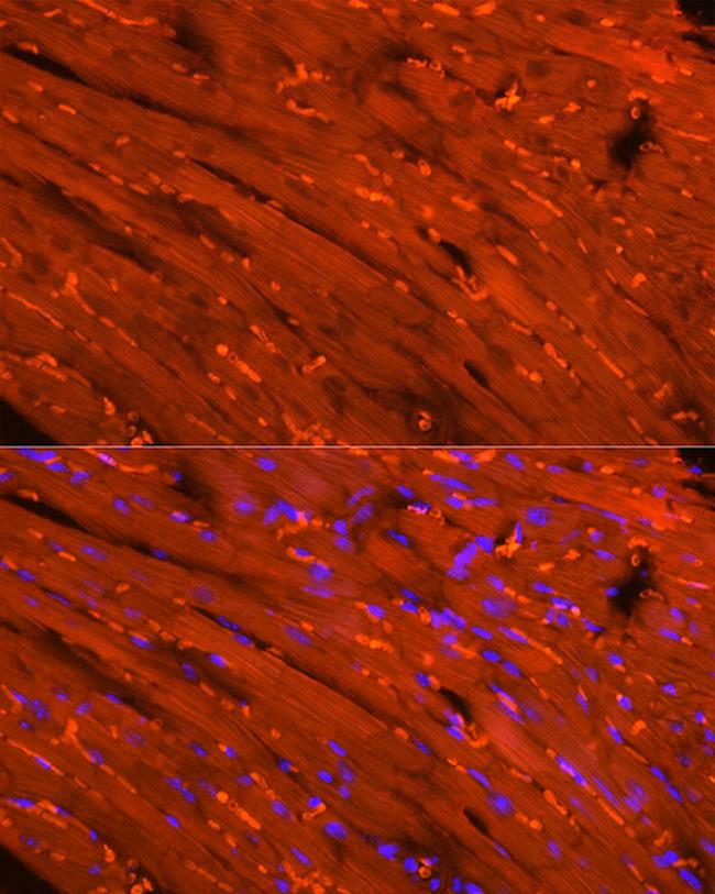 Creatine Kinase MB Antibody in Immunocytochemistry (ICC/IF)