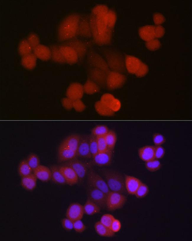 RPS27A Antibody in Immunocytochemistry (ICC/IF)