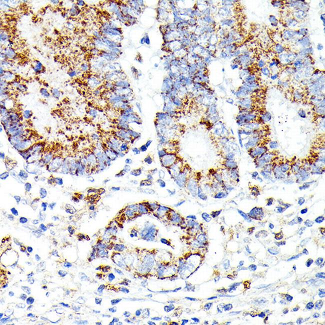 IL13RA2 Antibody in Immunohistochemistry (Paraffin) (IHC (P))