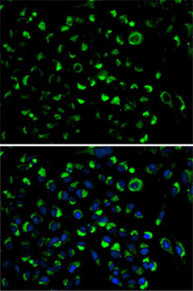 Adenylate Kinase 4 Antibody in Immunocytochemistry (ICC/IF)