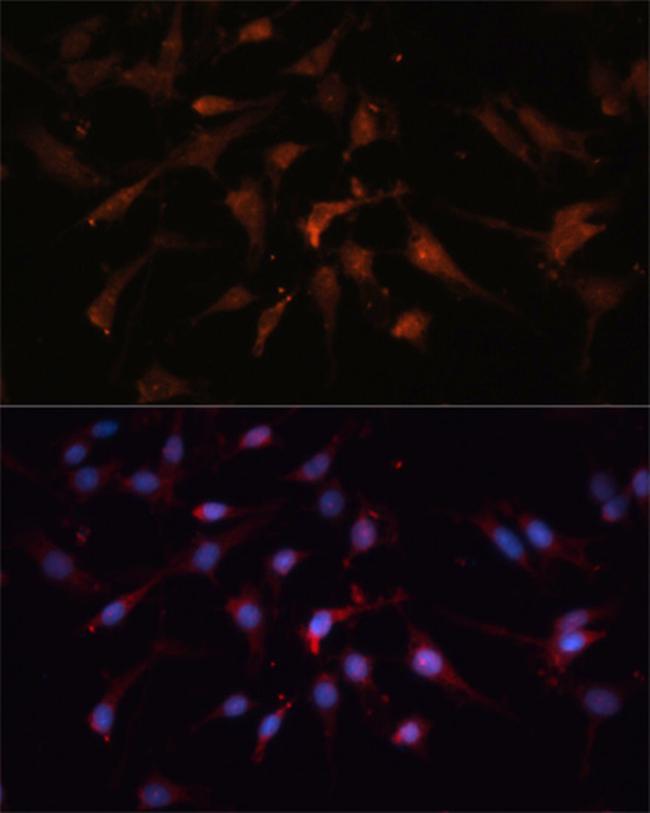 GSK3B Antibody in Immunocytochemistry (ICC/IF)